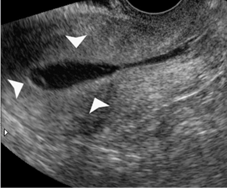 learning-fertility2 Learning fertility womb