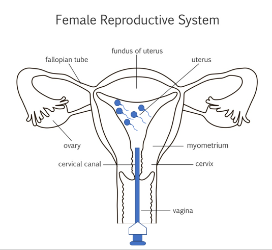 image001 Female Reproductive System