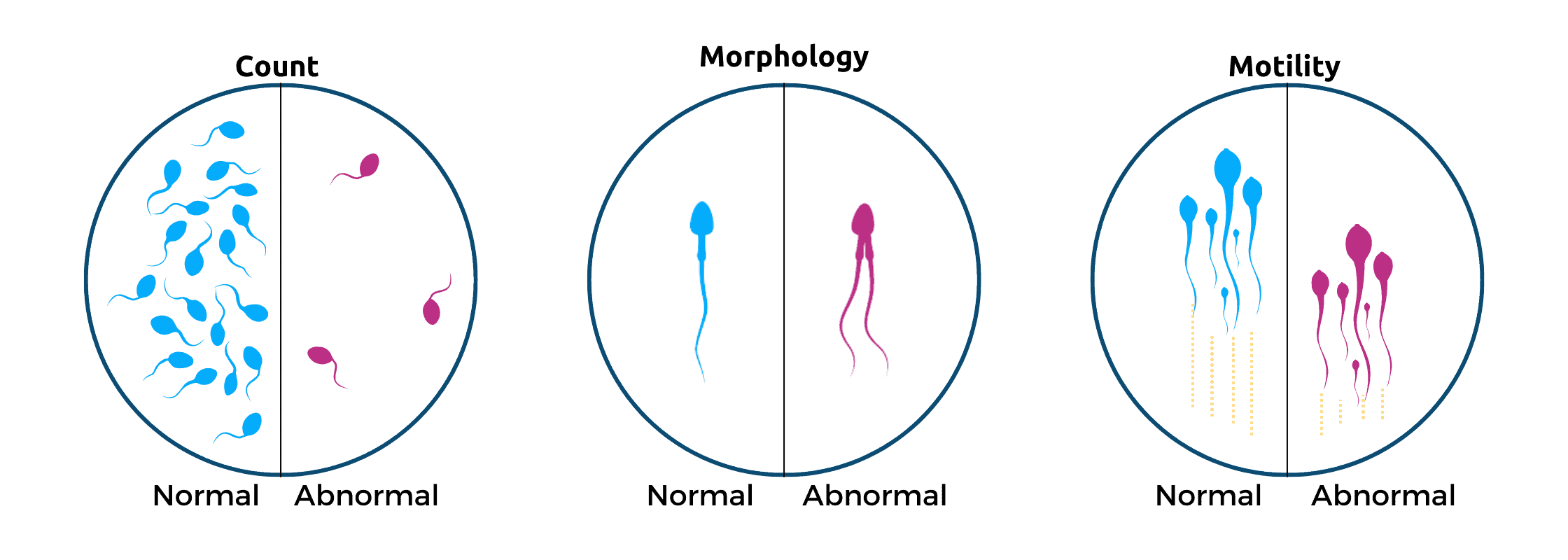Types of Semen Analysis