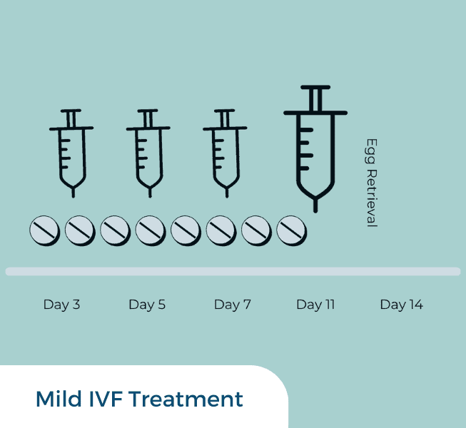 Mild IVF Treatment
