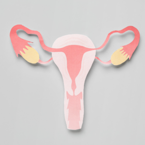 Endometriosis